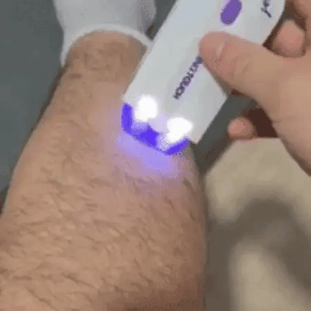 Depiladora Electrica ONE TOUCH YES