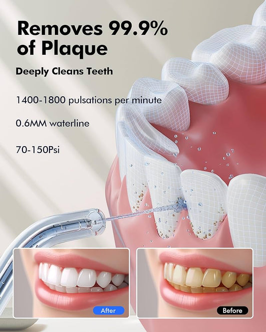 Higiene bucal profunda