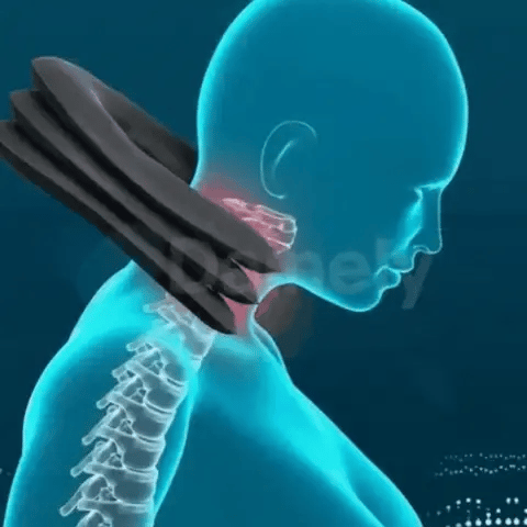 CUELLO CERVICAL INFLABLE